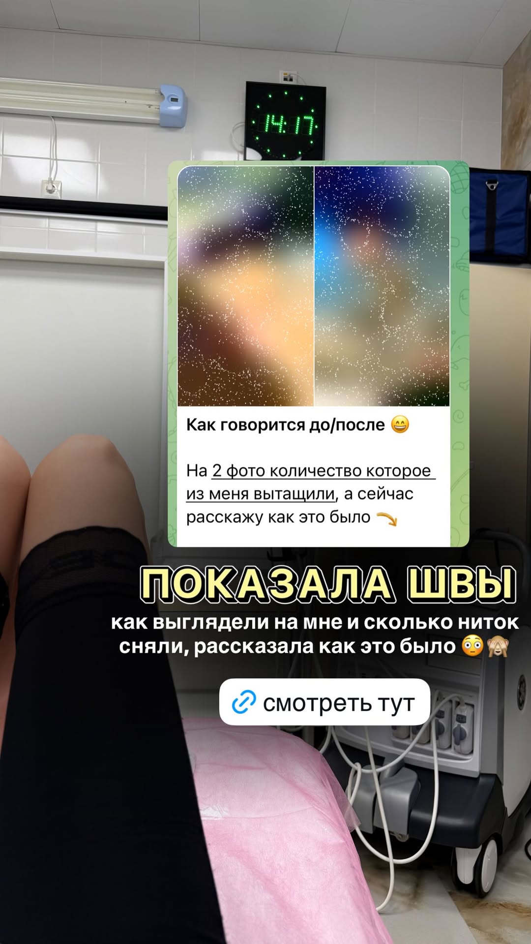 новая фото в сторис @comedymama_official 02.12.2025