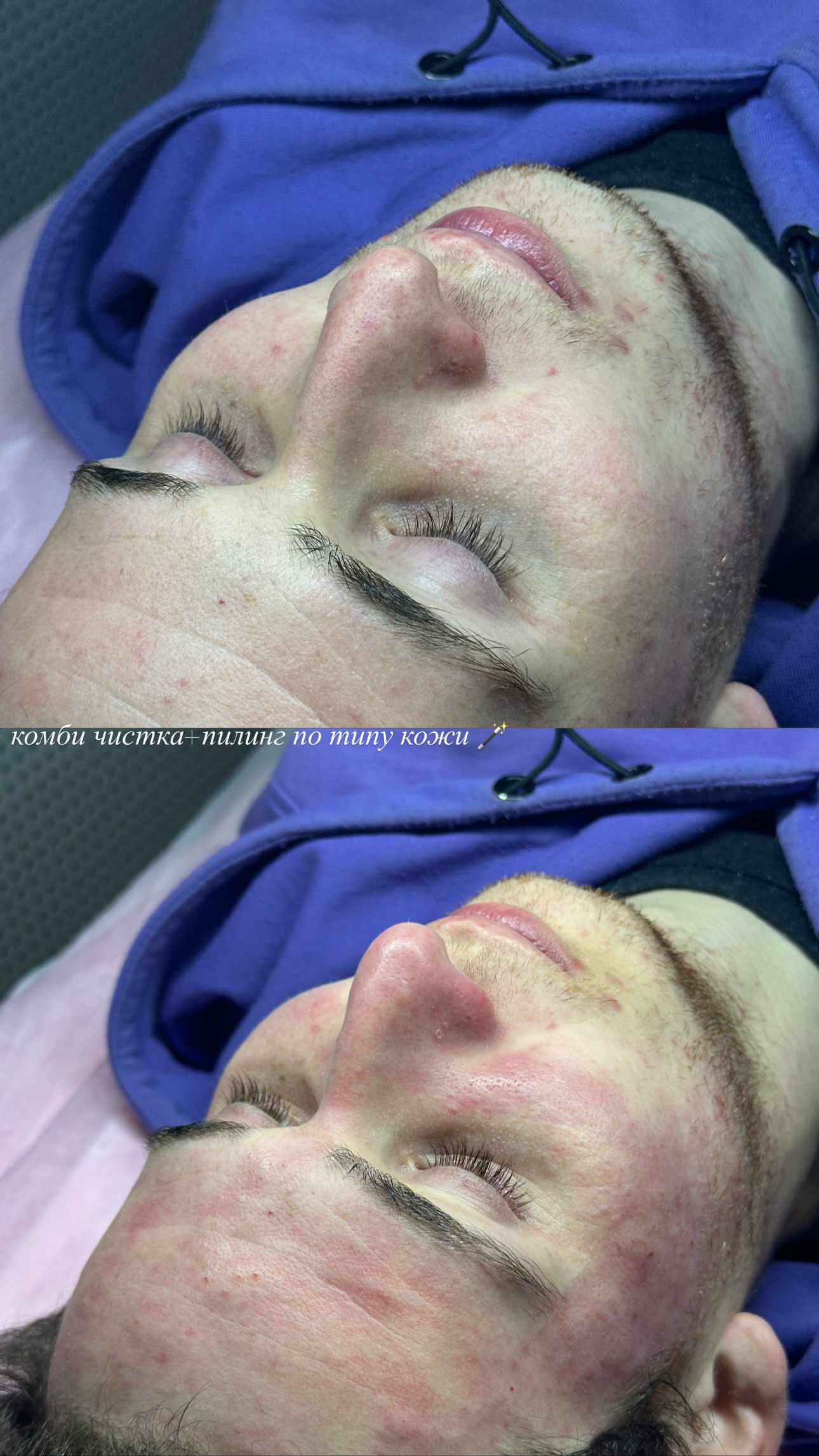 новая фото в сторис @dr_elisss 03.01.2026