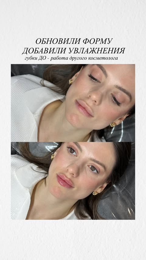 новая фото в сторис @dr_elisss 06.01.2026
