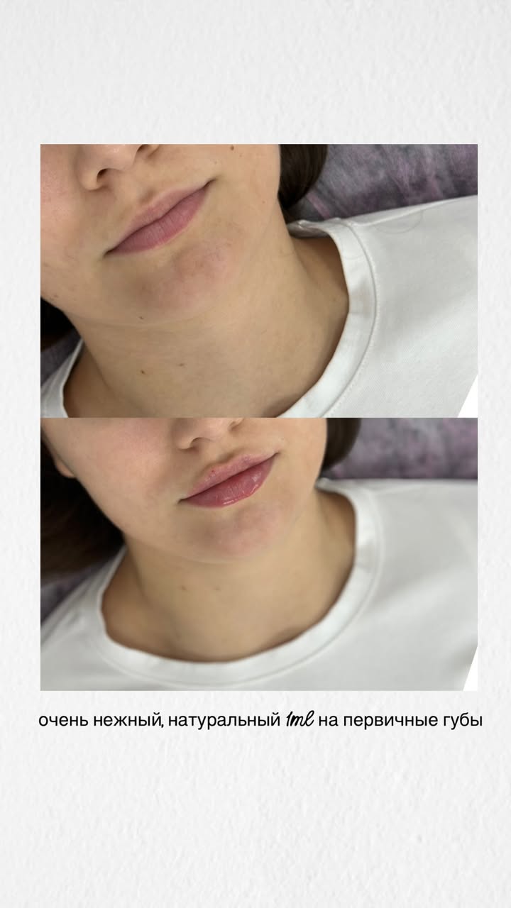 новая фото в сторис @dr_elisss 07.01.2026