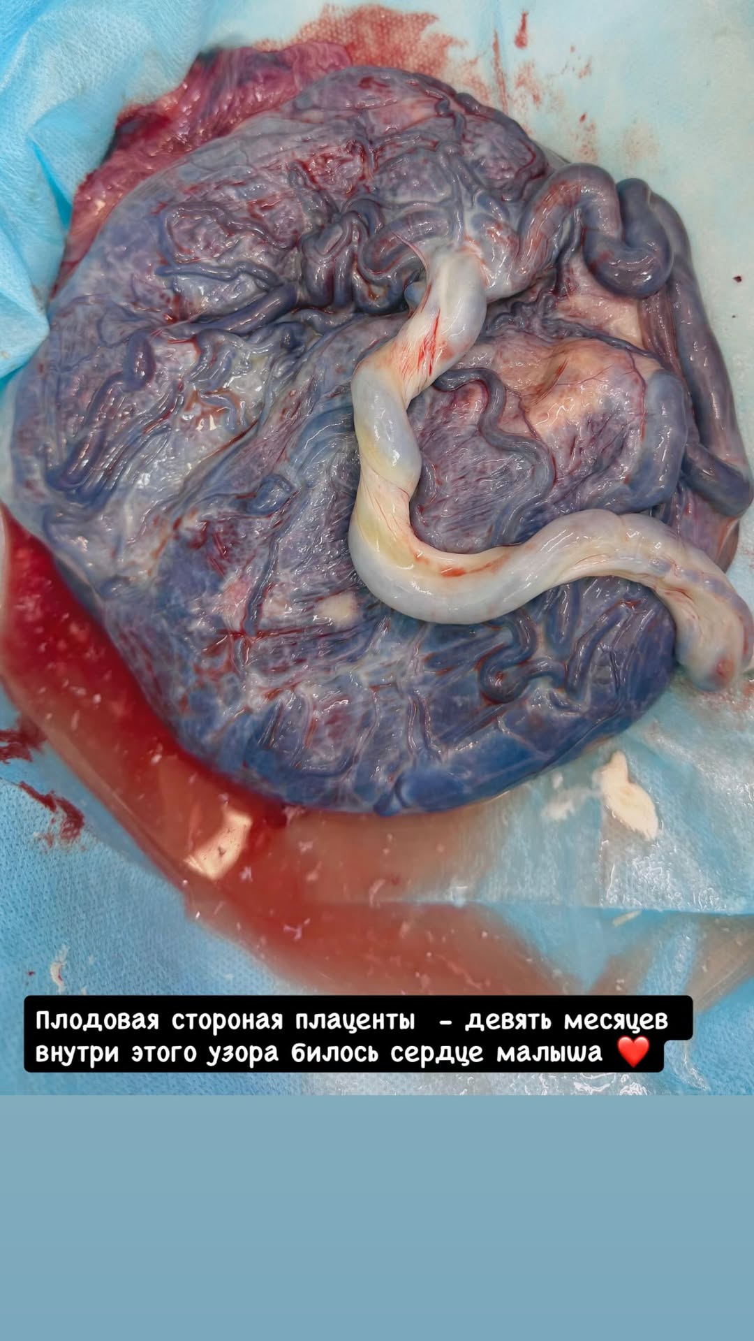 новая фото в сторис @gabaraeva0715 14.01.2026