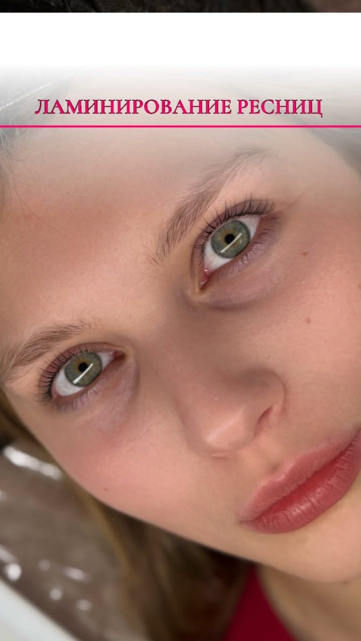 новая фото в сторис @resni_krasnoznamensk 24.01.2026