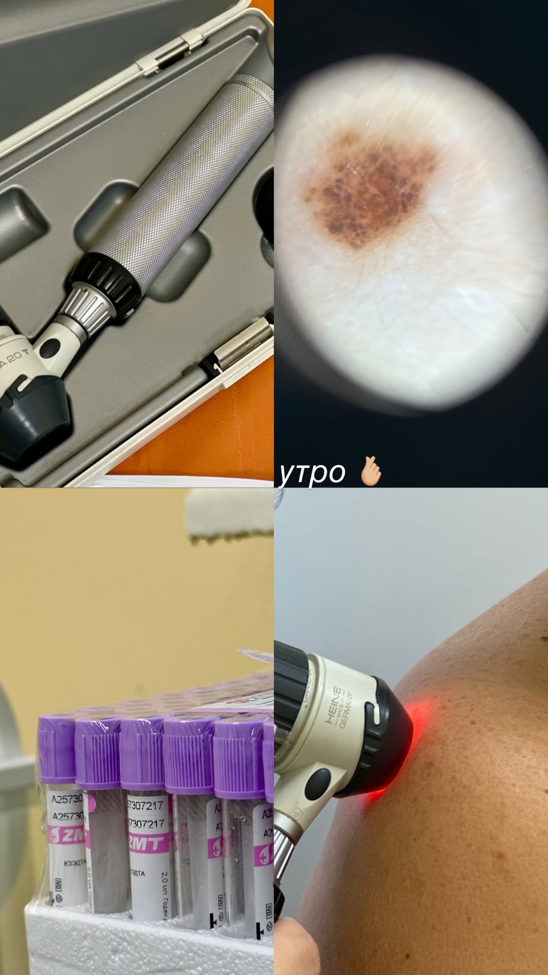 новая фото в сторис @dr_elisss 04.02.2026