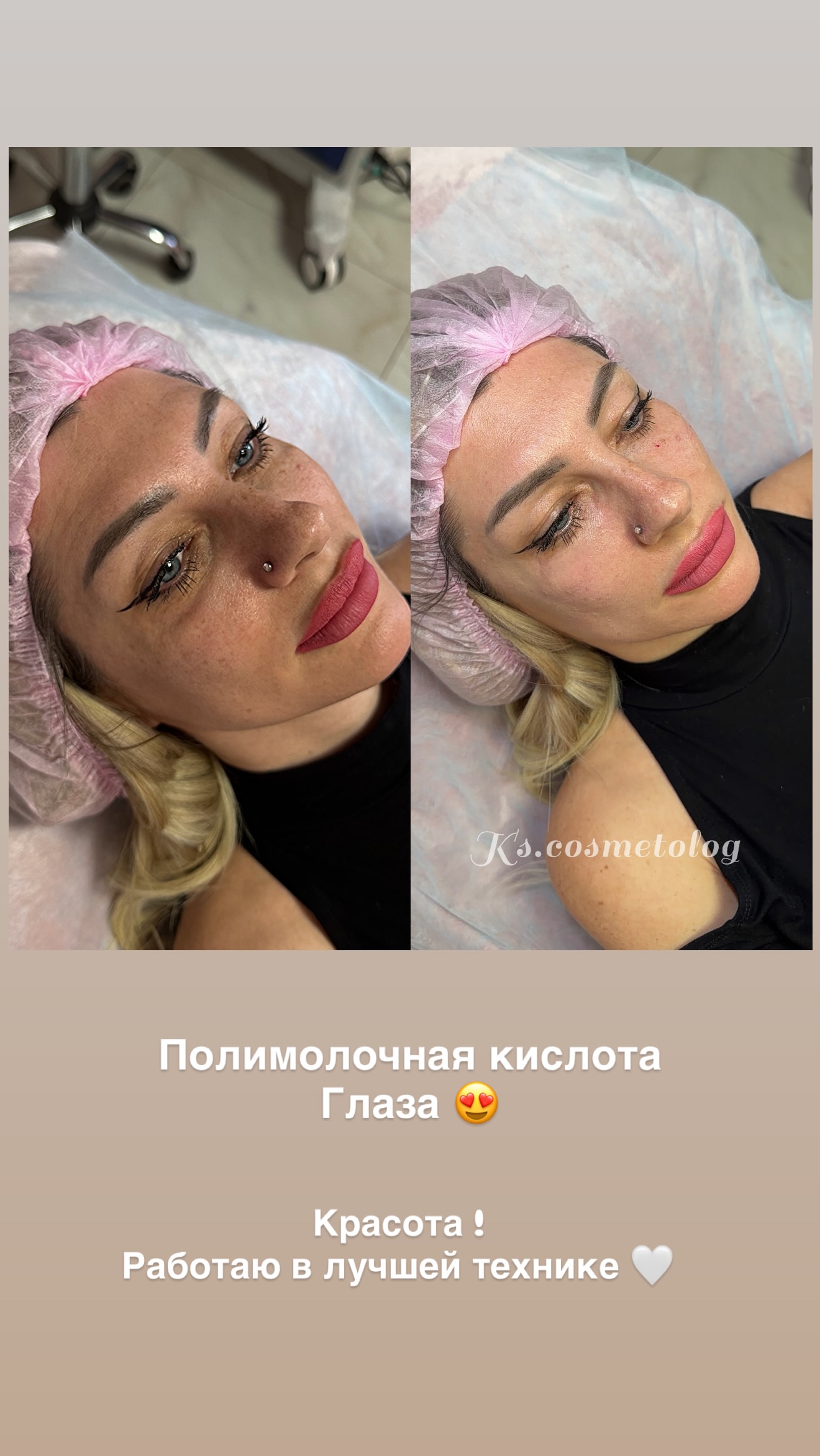 новая фото в сторис @ks.cosmetolog 05.02.2026