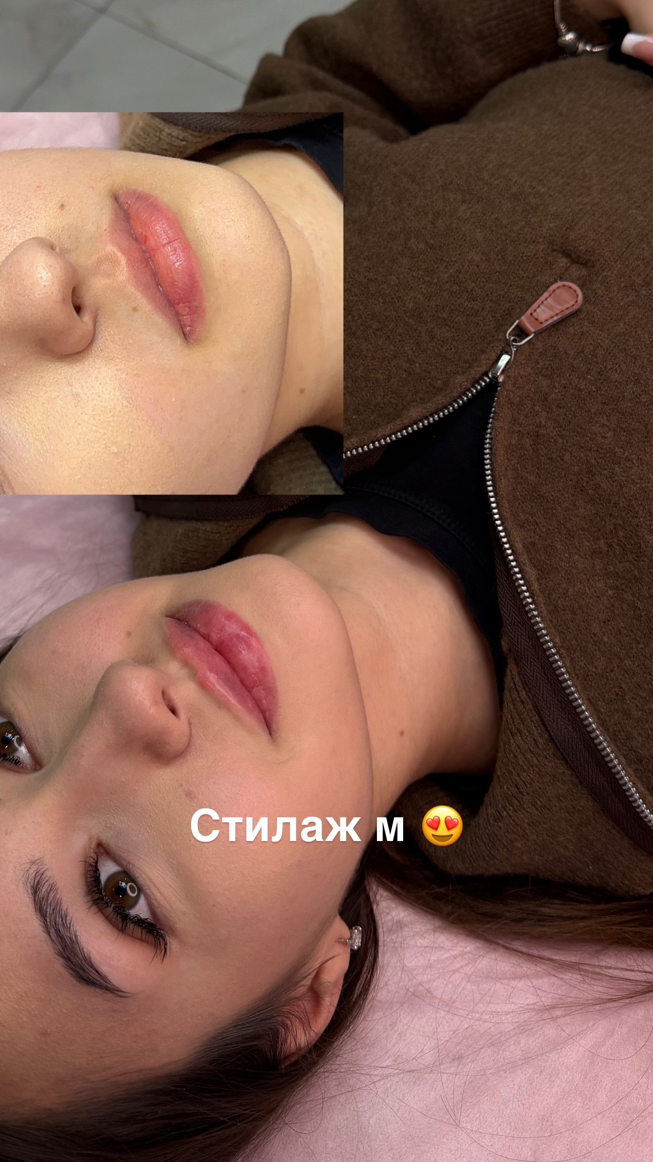 новая фото в сторис @ks.cosmetolog 05.02.2026