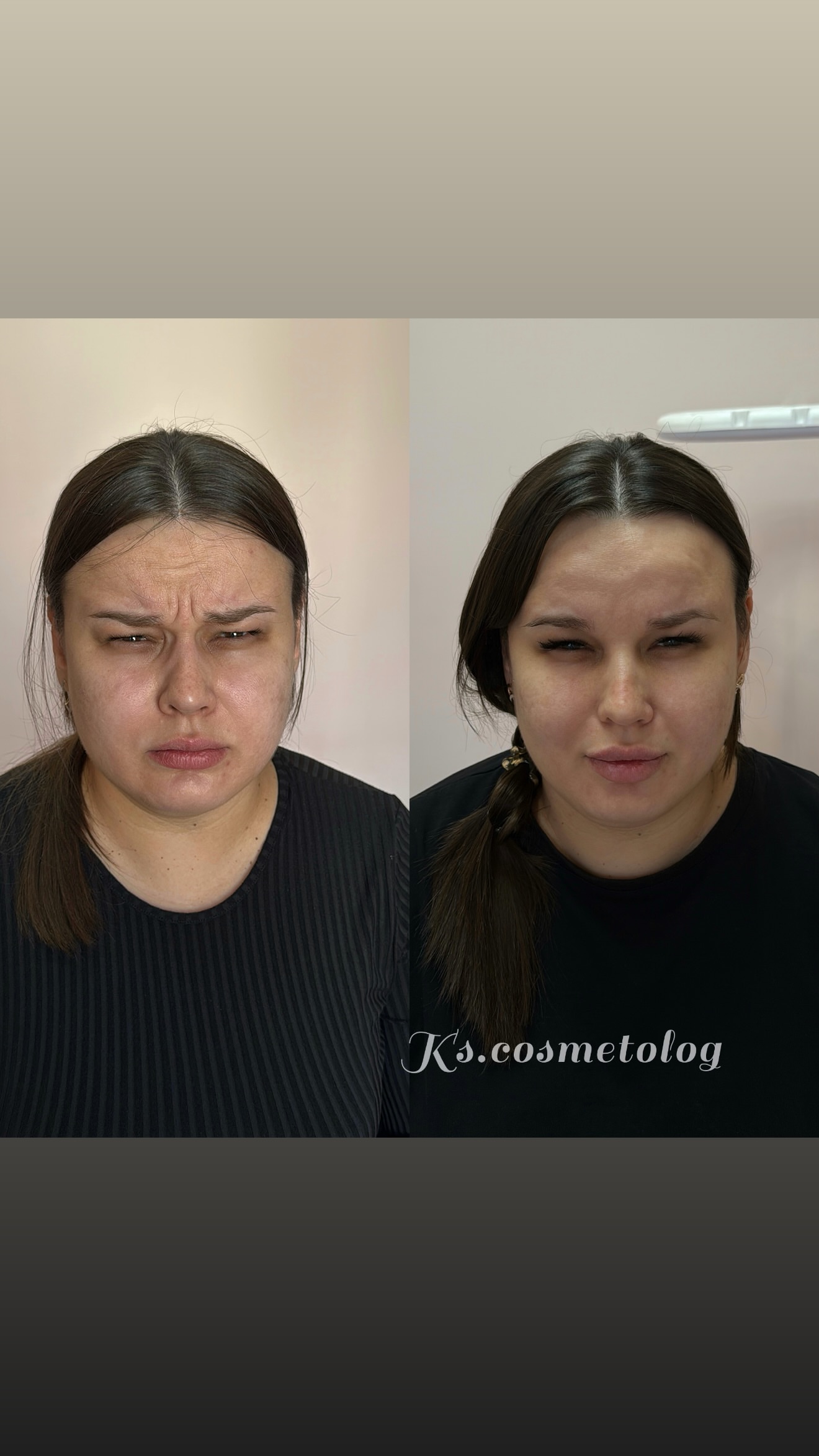 новая фото в сторис @ks.cosmetolog 05.02.2026