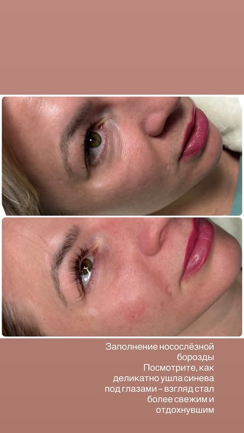 новая фото в сторис @tvoy.cosmetolog_ 06.02.2026