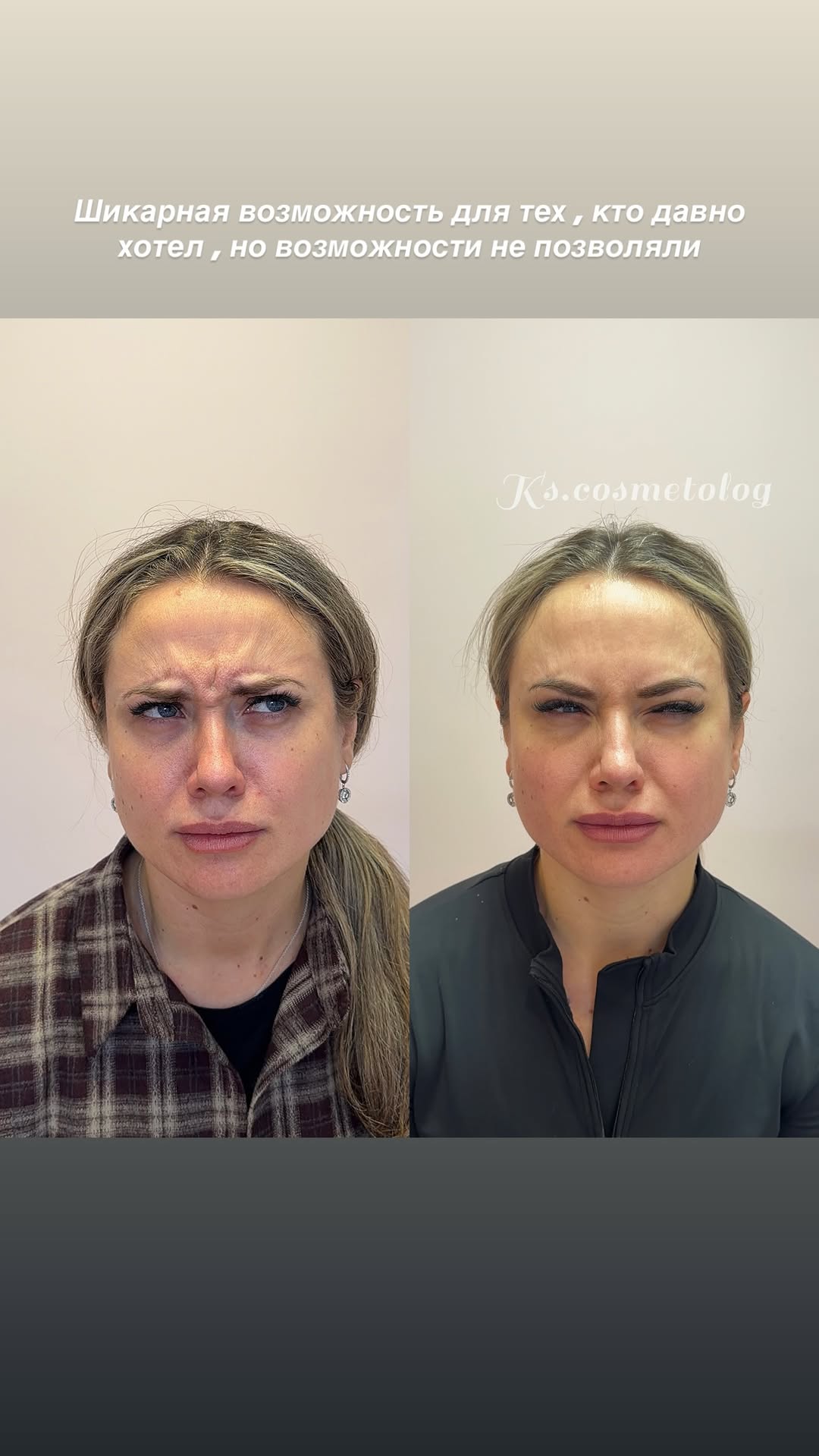новая фото в сторис @ks.cosmetolog 08.02.2026