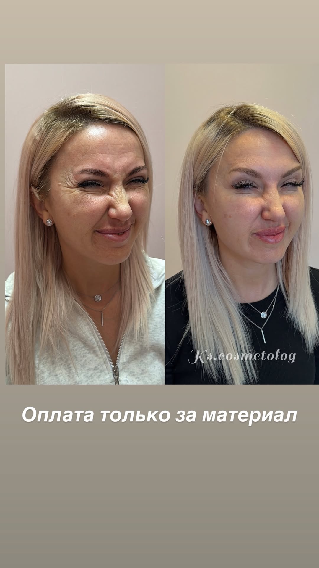 новая фото в сторис @ks.cosmetolog 08.02.2026