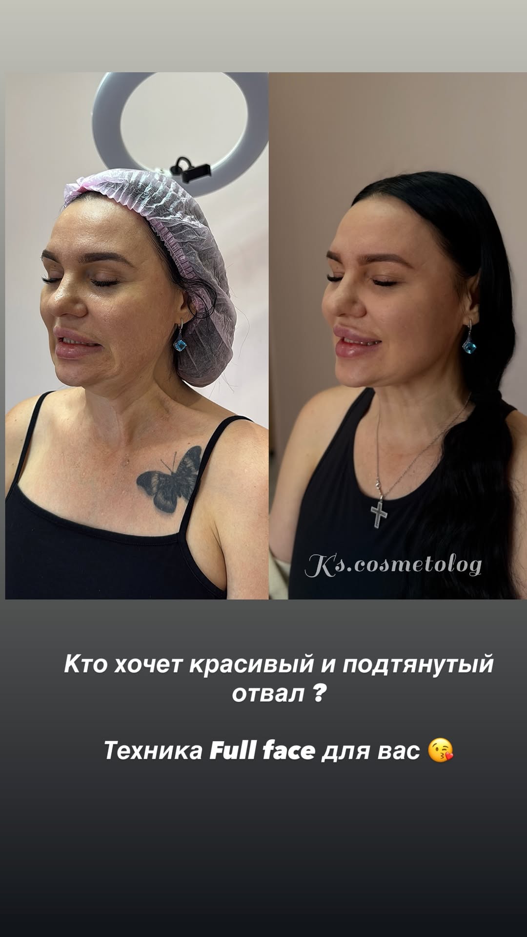 новая фото в сторис @ks.cosmetolog 08.02.2026