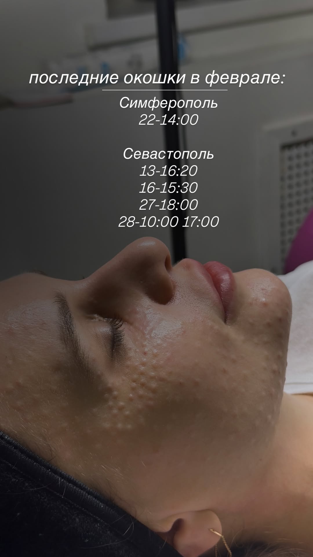 новая фото в сторис @dr_elisss 09.02.2026