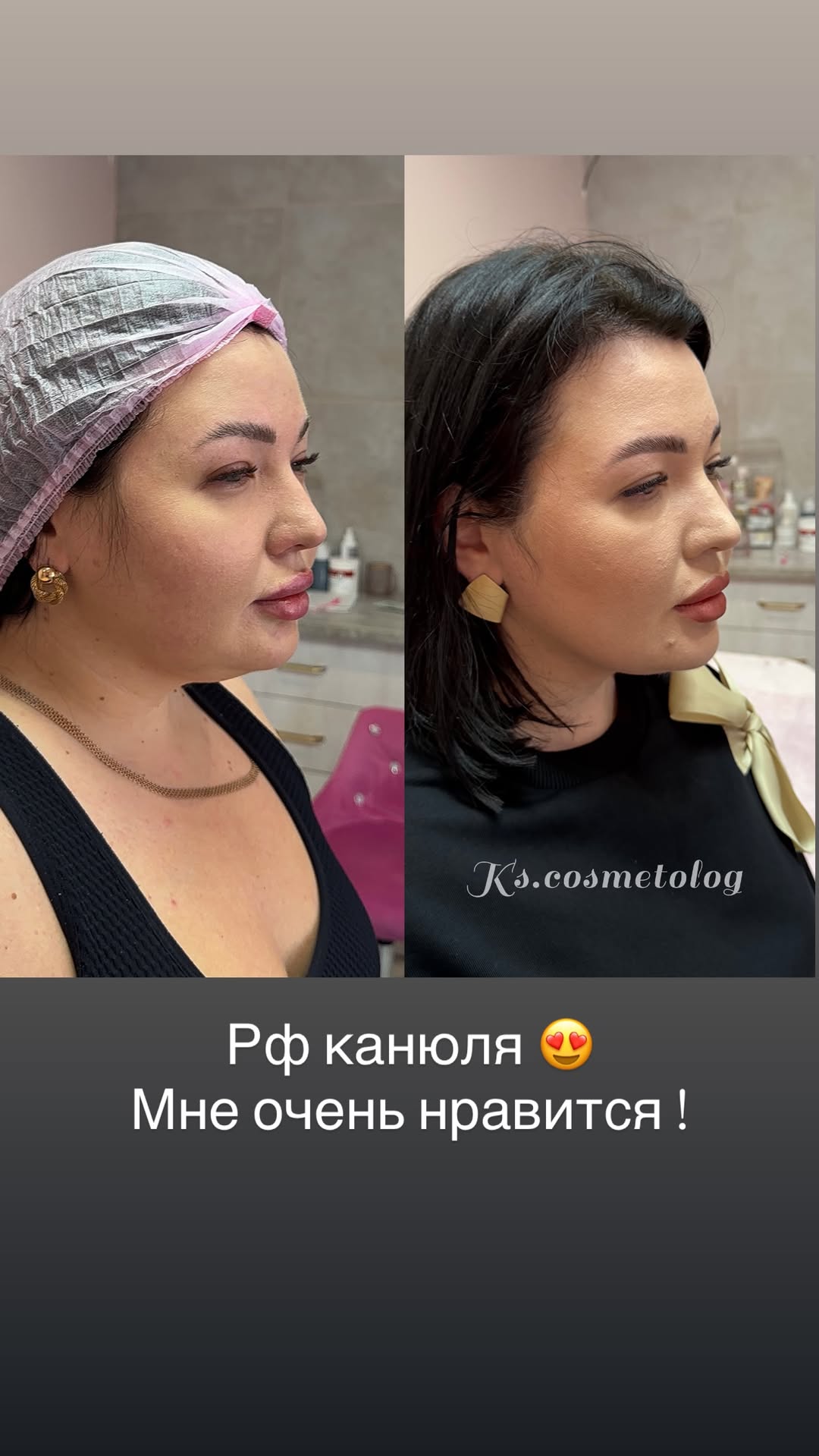 новая фото в сторис @ks.cosmetolog 11.02.2026