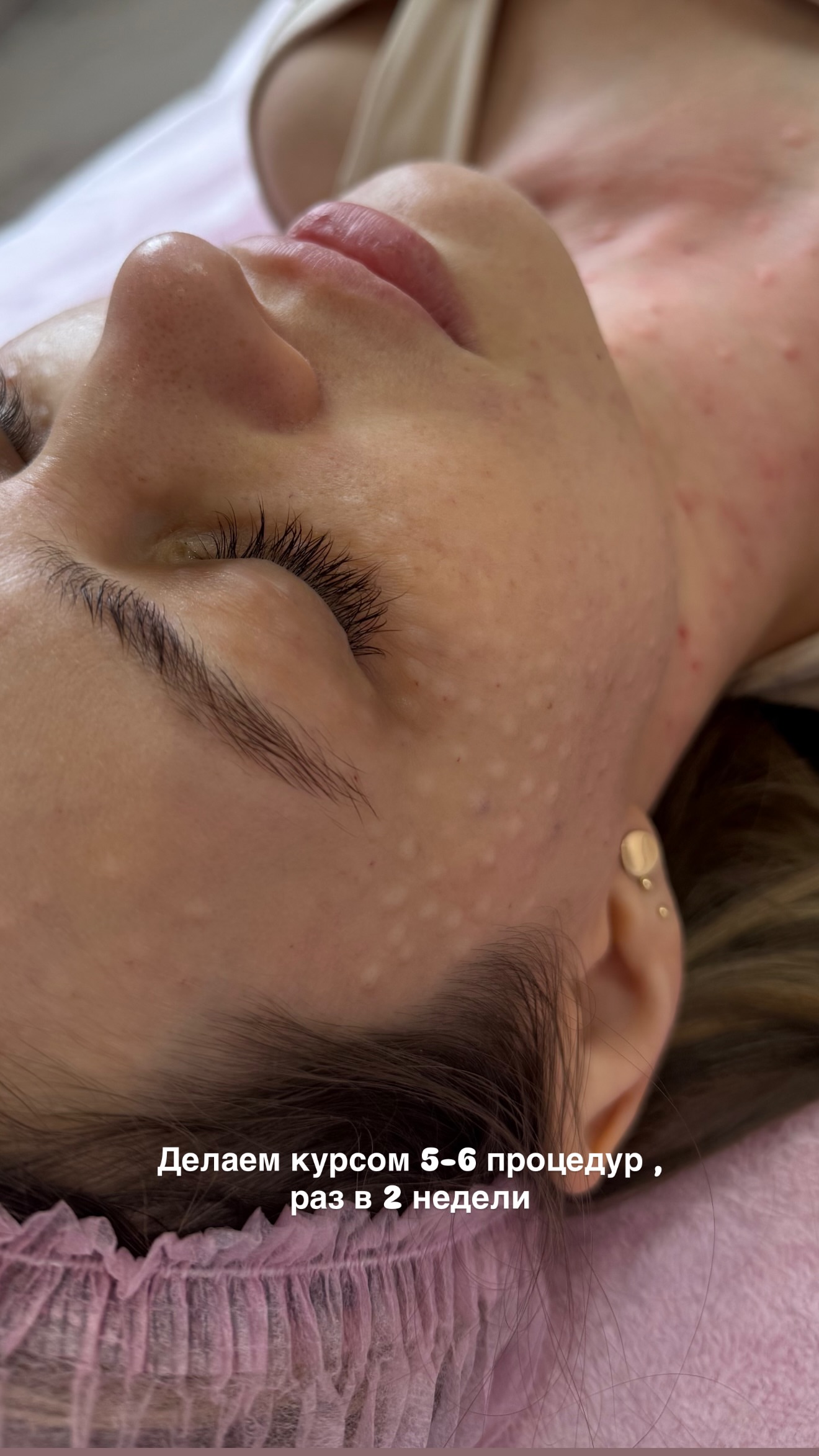 новая фото в сторис @ks.cosmetolog 13.02.2026