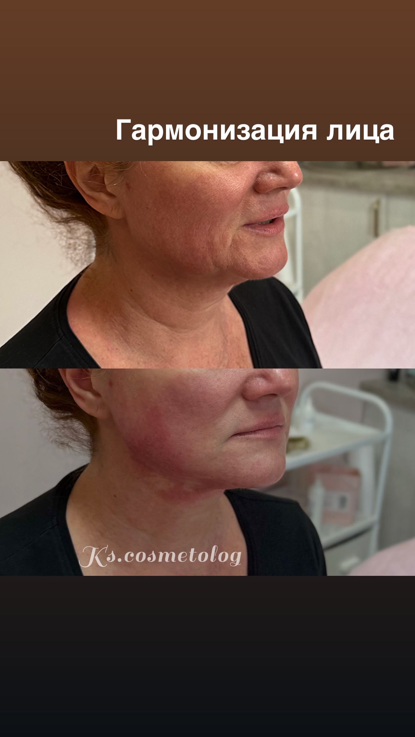 новая фото в сторис @ks.cosmetolog 13.02.2026