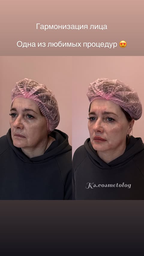 новая фото в сторис @ks.cosmetolog 20.02.2026