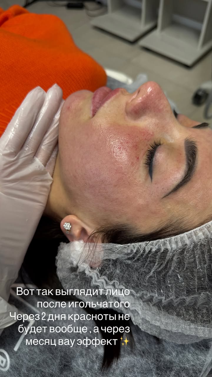 новая фото в сторис @tvoy.cosmetolog_ 25.02.2026