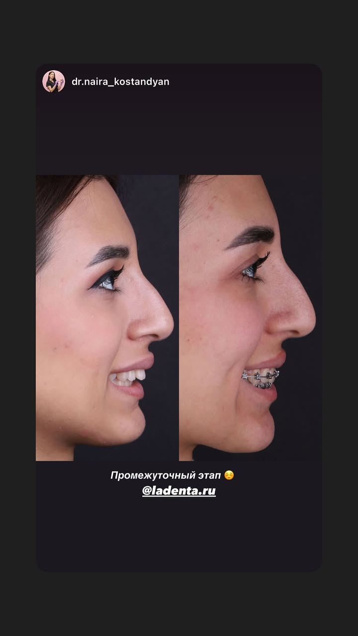 новая фото в сторис @nigulyaashinova 26.02.2026