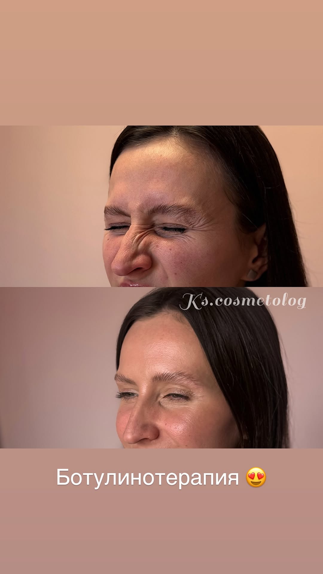 новая фото в сторис @ks.cosmetolog 28.02.2026