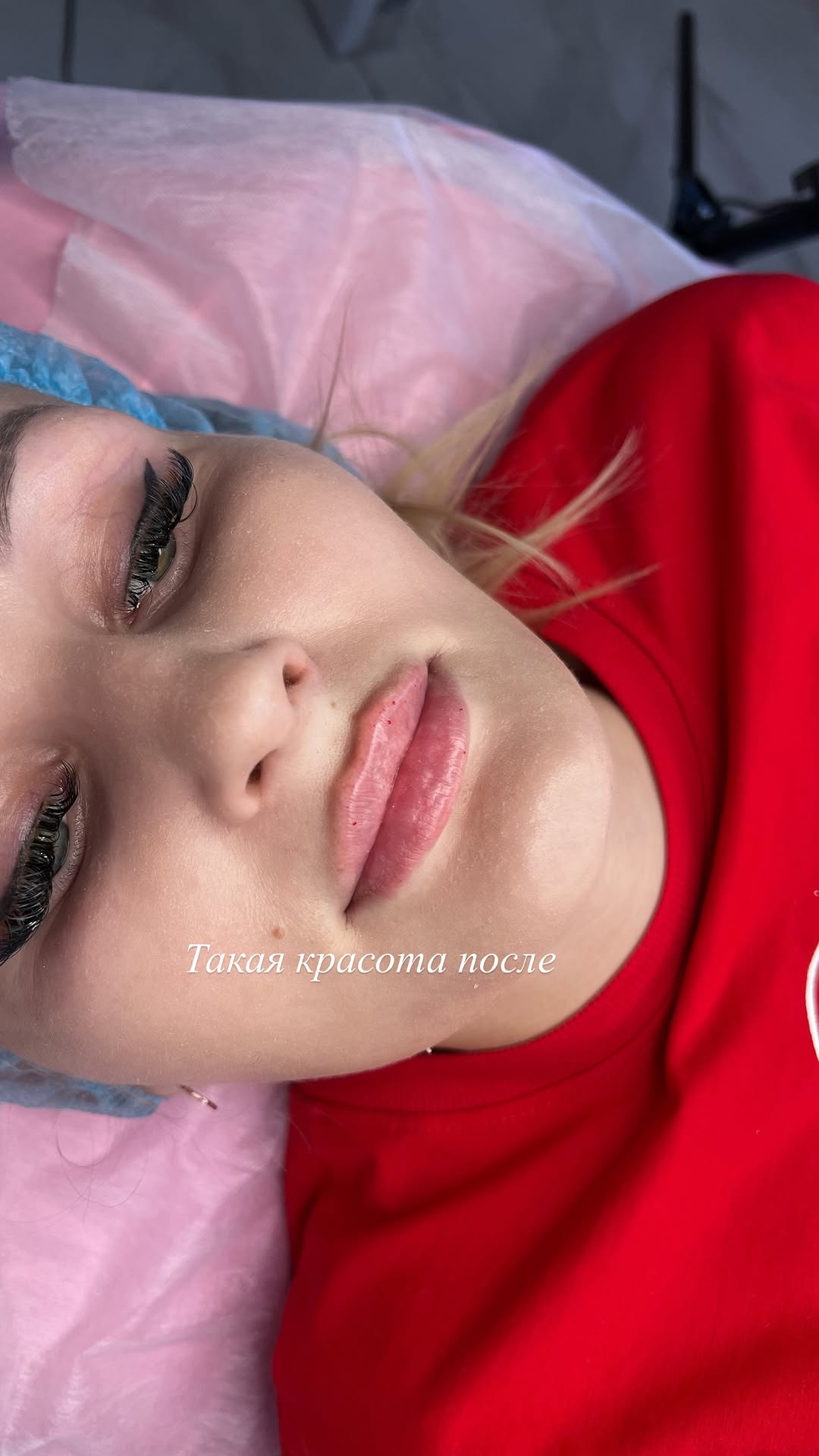 новая фото в сторис @ks.cosmetolog 28.02.2026