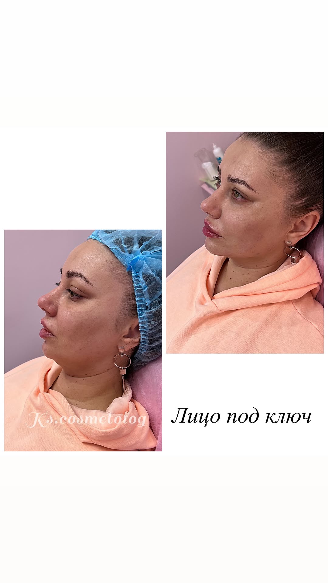 новая фото в сторис @ks.cosmetolog 28.02.2026