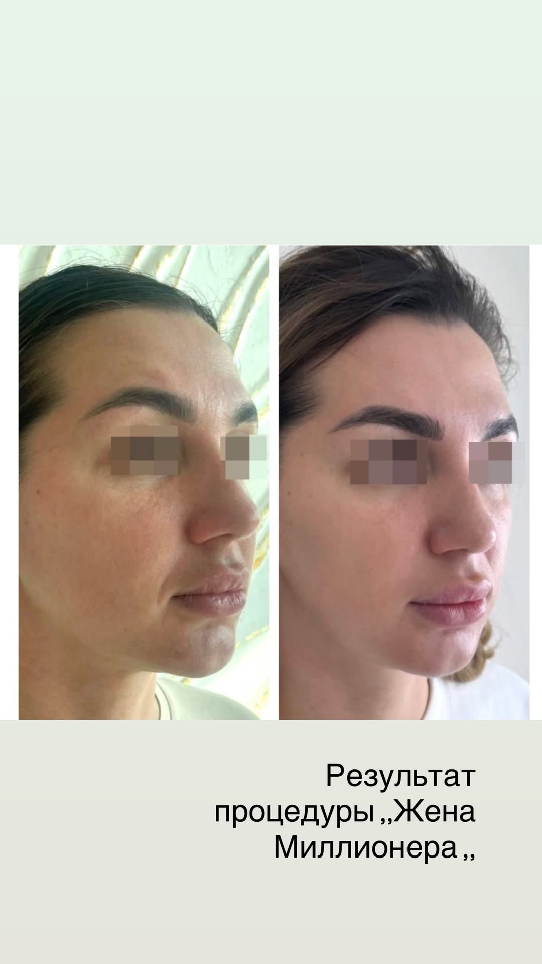 новая фото в сторис @tvoy.cosmetolog_ 06.03.2026