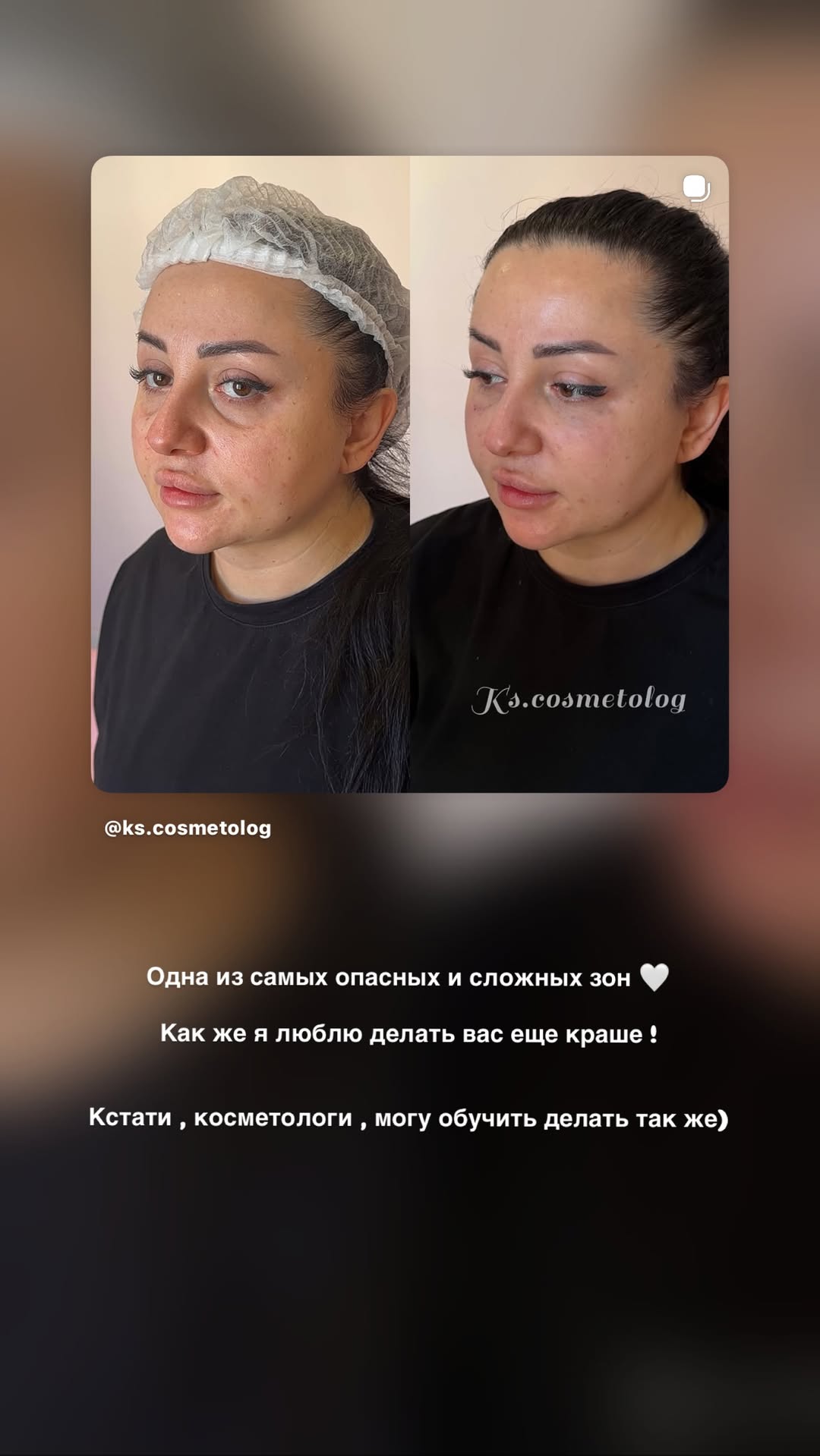 новая фото в сторис @ks.cosmetolog 06.03.2026